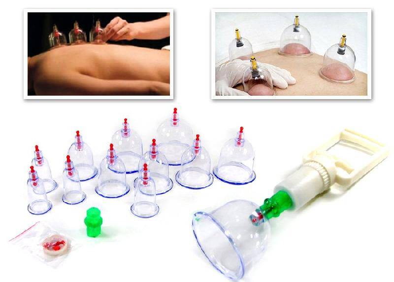 12 parça vakumlu hacamat kupa çekme seti - 1