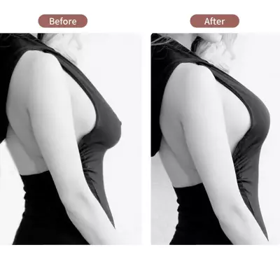 Göğüs Dikleştirme Bandı S Beden 2.5 Cm. (1)