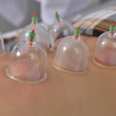 Hacamat Kupa Seti 6 Adet - 3